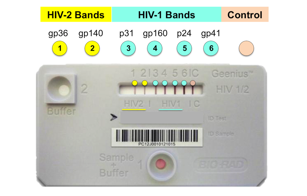 Core Concepts HIV Diagnostic Testing Screening and Diagnosis