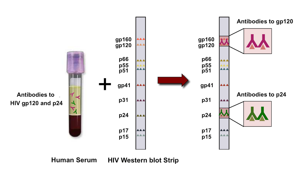 western blot test for hiv